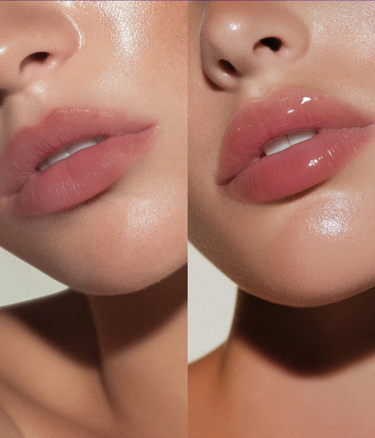 hot plump before and after